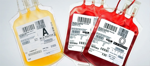 Padova: una speranza dalla terapia con il plasma dei guariti