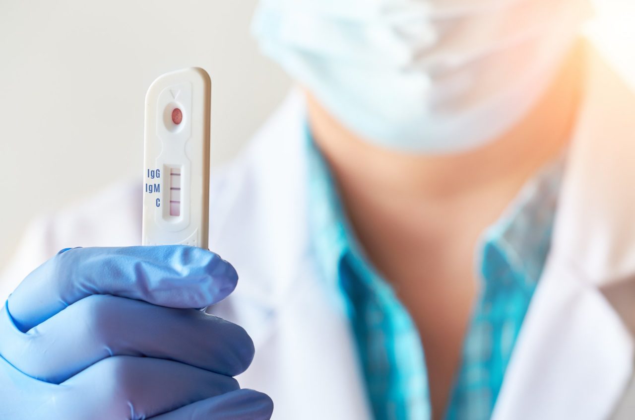 I medici veneti sull’obbligo di tamponi: “Non trattateci come renitenti alla leva”