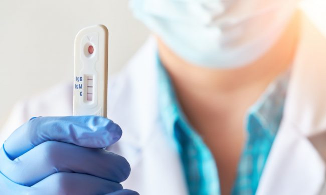 Tamponi rapidi, Zaia precetta anche i veterinari: “L’uomo è un mammifero”