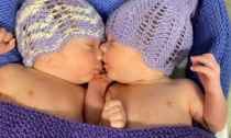 Il "doppio miracolo" di Diego e Daniel, gemelli nati prematuri a Cittadella