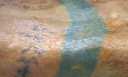 Il mistero del cadavere coi tatuaggi: sarebbe un padovano dei Colli Euganei