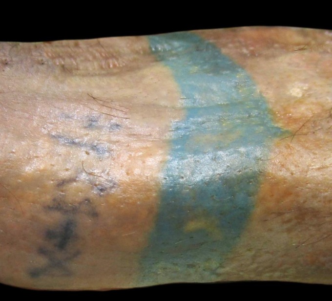 Il mistero del cadavere coi tatuaggi: sarebbe un padovano dei Colli Euganei