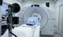 Scoperto a Padova un tumore al fegato mai visto prima in un paziente di 40 anni
