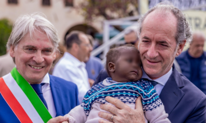 Dalla Sierra Leone a Padova per una grave cardiopatia, il bimbo Imran salvato a 8 mesi