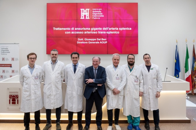 Prima mondiale a Padova: trattato un aneurisma gigante con accesso percutaneo attraverso la milza