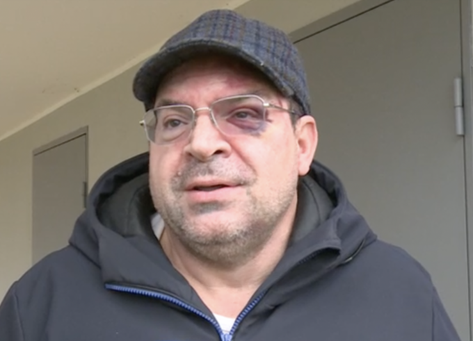 Baby gang cerca di sfondare la porta di casa sua, 55enne interviene e viene aggredito a calci e pugni