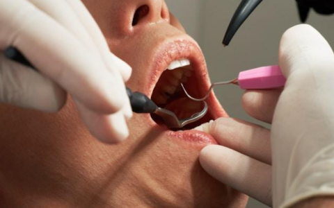 Odontofobia: quando l’ansia diventa un ostacolo alle cure