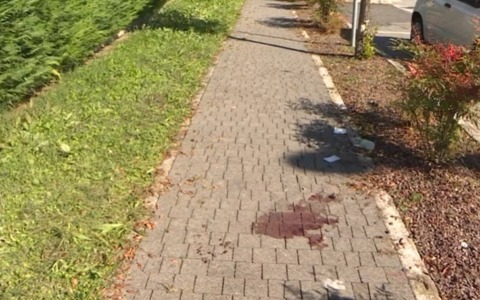 Due 23enni accoltellati mentre sedano una lite a Casalserugo. Venturini: “Queste baby gang vanno fermate”
