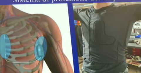 17enne torna a sciare grazie al defibrillatore sottocutaneo: a Padova risolto caso di sindrome di Brugada