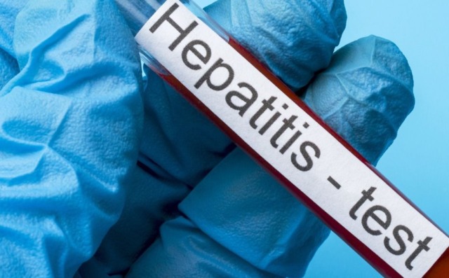 Caso di Epatite A registrato a Padova: è un turista rientrato da Napoli